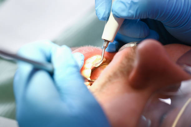 Best Emergency Gum Treatment in Como, MS