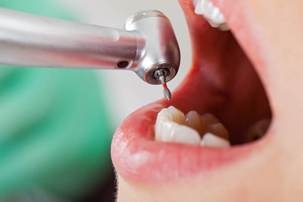 Best Emergency Root Canal Treatment in Como, MS